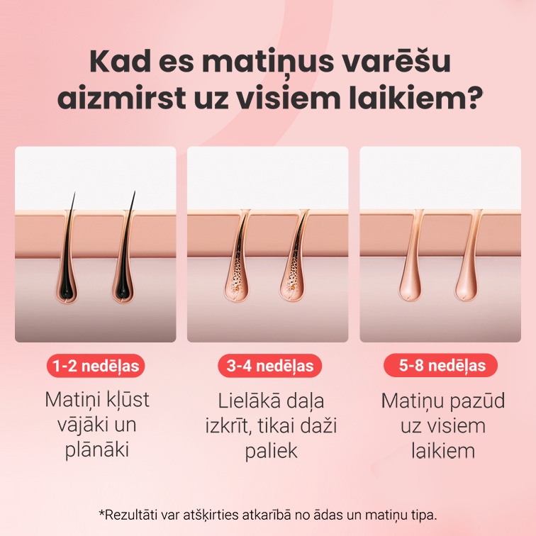 Matiņu noņemšanas komplekts Hilda IPL Quartz
