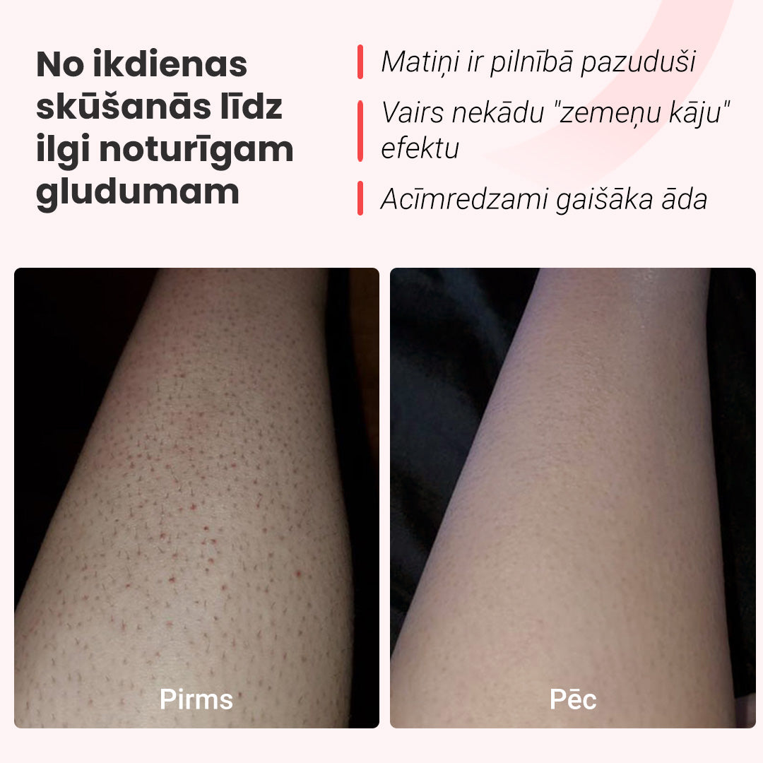 Matiņu noņemšanas komplekts Hilda IPL Quartz