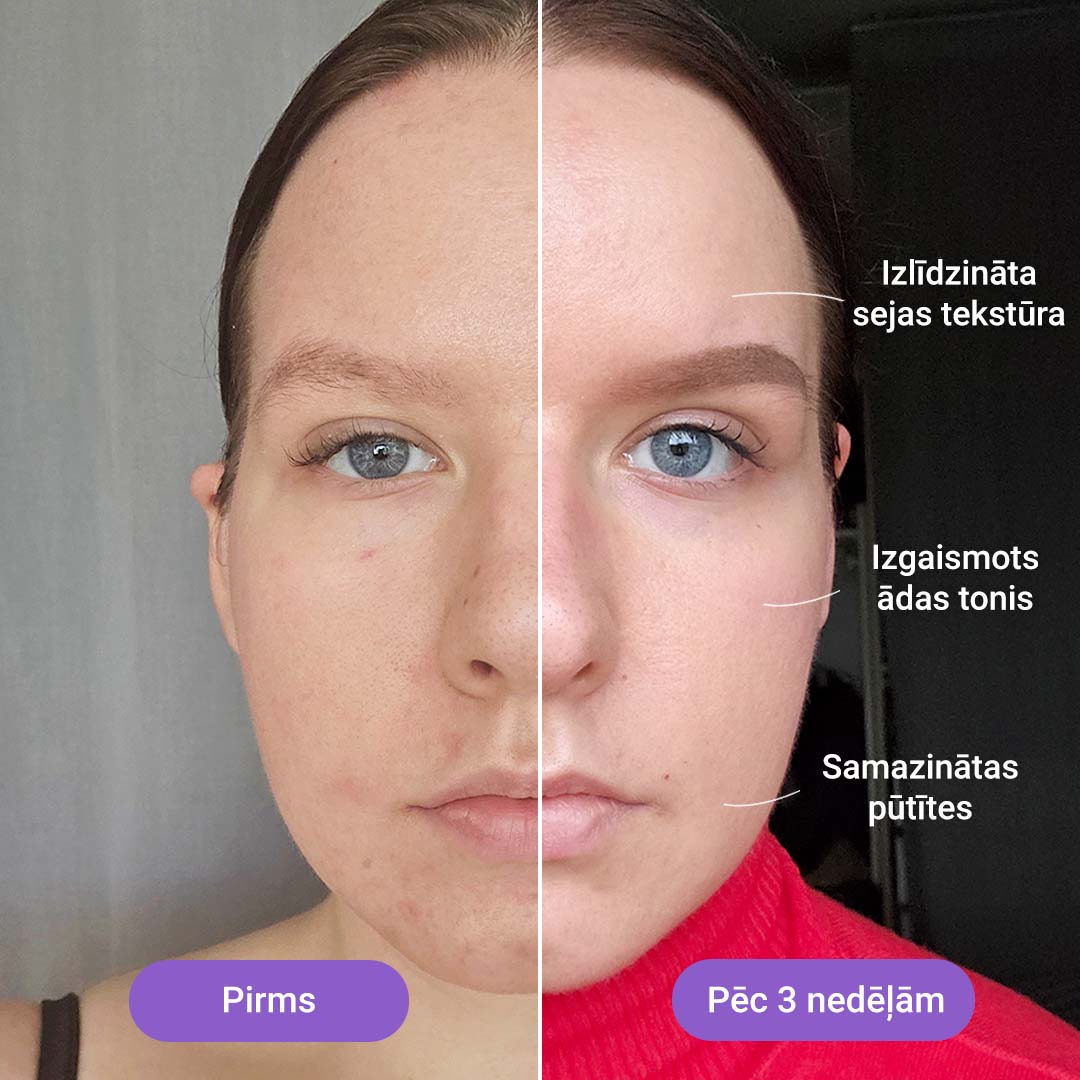 Gaismas terapijas maska Lumi