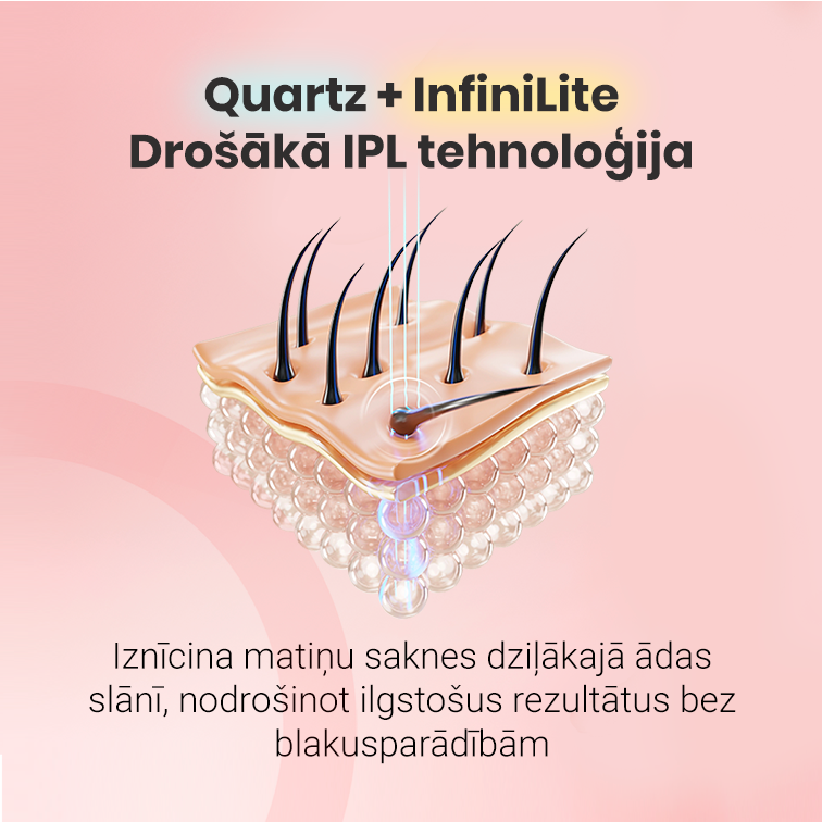 Fotoepilatori IPL®